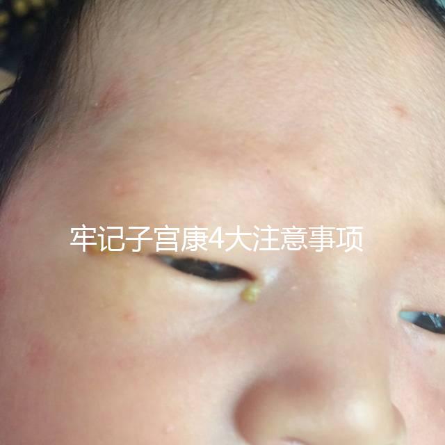 牢記子宮康4大注意事項，輕松避免胃脹、腹瀉等副作用