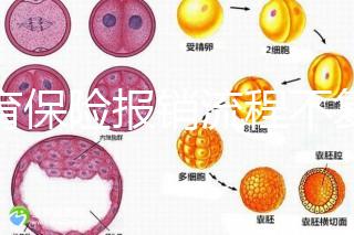 生育保險(xiǎn)報(bào)銷流程不復(fù)雜，辦理地點(diǎn)不分地域異地可報(bào)銷