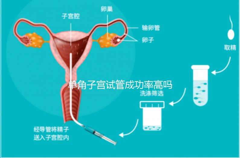 單角子宮試管成功率高嗎？送你5招降低胚胎著床的難度