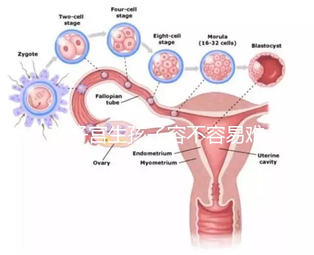 雙子宮生孩子容不容易難產看情況,注意這幾點也能順利抱娃