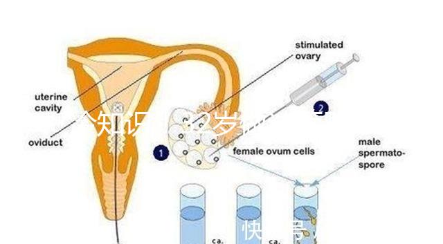 冷知識!32歲做試管嬰兒提升成功率的方法請收藏