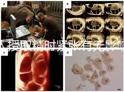 人授取精時(shí)緊張有無(wú)影響別還不造，注意事項(xiàng)不少不可不知