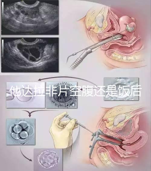他達(dá)拉非片空腹還是飯后吃看這，控制好用藥時(shí)間效果佳