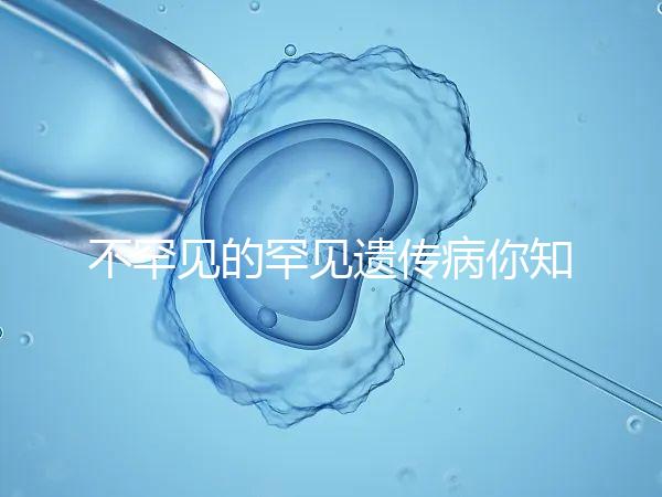 不罕見的罕見遺傳病你知道嗎？帶你認識下特納綜合癥