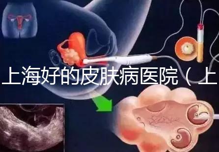 上海好的皮膚病醫院(上海皮膚科排名第一)
