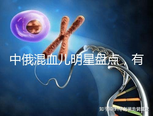 中俄混血兒明星盤點，有的長相特征真不明顯