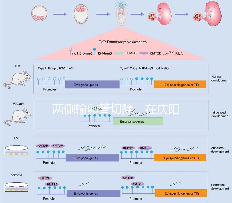 兩側輸卵管切除，在慶陽有醫院能做試管嬰兒嗎？