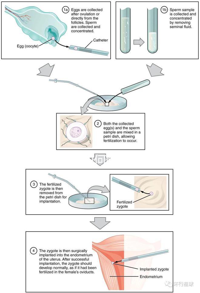 懷孕期間如何降血糖效果更好?