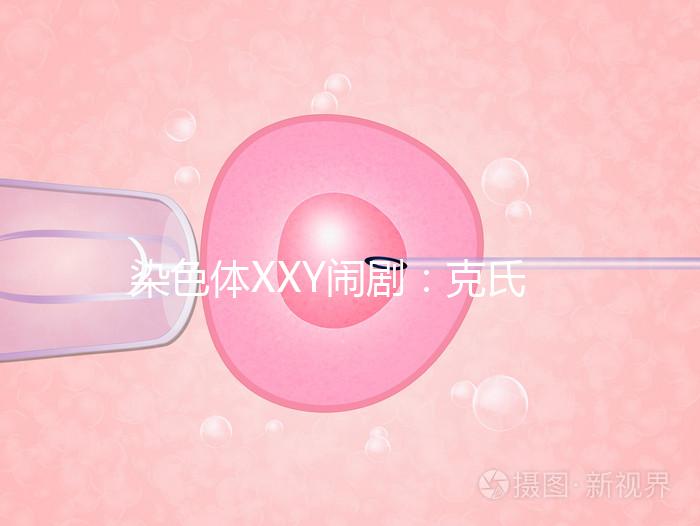 染色體XXY鬧?。嚎耸暇C合征，帶你走進“第三性別”群體