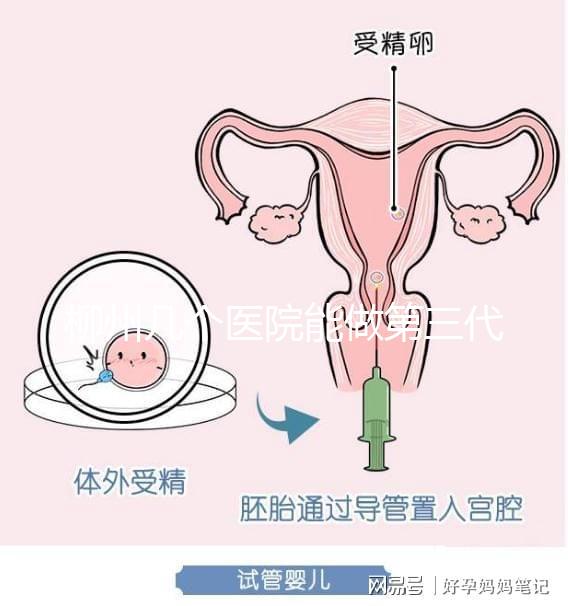 柳州幾個(gè)醫(yī)院能做第三代試管嬰兒？詳細(xì)的費(fèi)用成功率都在這