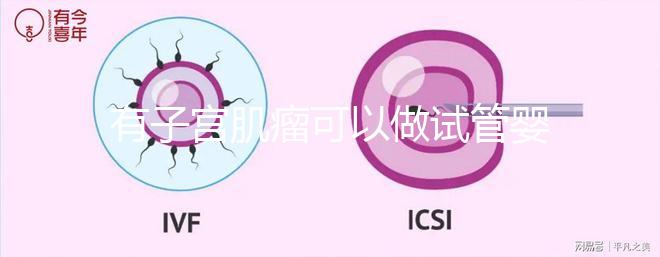 有子宮肌瘤可以做試管嬰兒?jiǎn)幔ㄓ凶訉m肌瘤可以做試管嬰兒?jiǎn)岫嗌馘X)