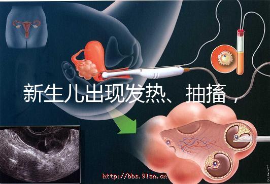 新生兒出現發熱、抽搐，很可能是胎毒的表現