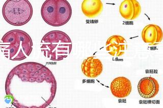 無痛人流有哪些注意事項？