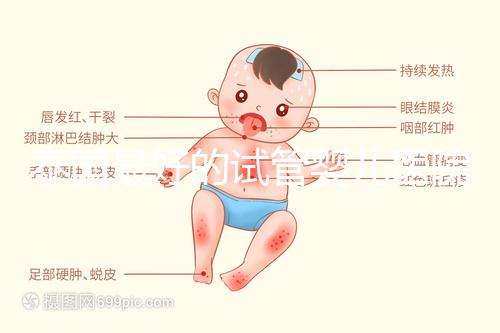 泰國最好的試管嬰兒醫院（泰國最好的試管嬰兒醫院是哪個）