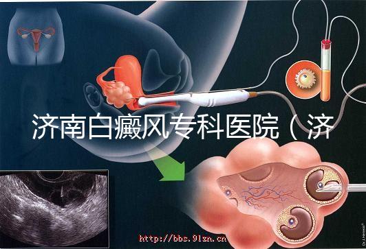 濟南白癜風(fēng)專科醫(yī)院(濟南白點癲風(fēng)醫(yī)院排名)
