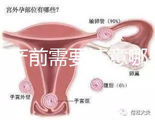 孕婦產前需要注意哪些事項?