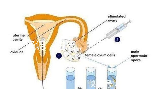降調，進周，囊胚……這些試管嬰兒助孕術語你都懂嗎？