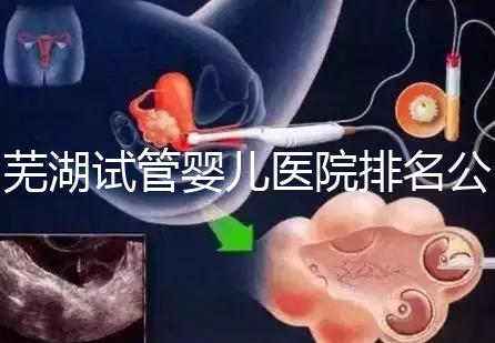 蕪湖試管嬰兒醫院排名公開，弋磯山醫院、蕪湖二院獲好評