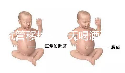 試管移植前幾天喝酒了有影響嗎？想要懷孕得管住嘴！