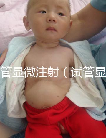 試管顯微注射(試管顯微注射什么藥)