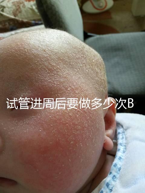 試管進周后要做多少次B超？需要檢查什么？進來看看