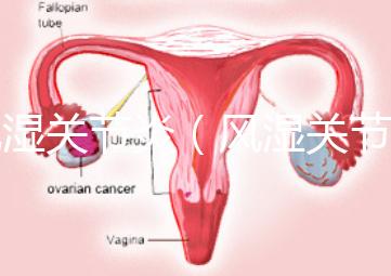 風(fēng)濕關(guān)節(jié)炎(風(fēng)濕關(guān)節(jié)炎的癥狀有哪些)