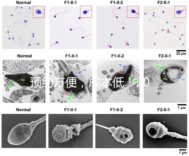 預約方便，成本低！2024年西安新城、臨潼、雁塔四維彩超指南