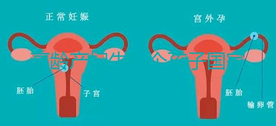 高齡產婦生八個孩子國家有補助？有沒有違法才是關鍵