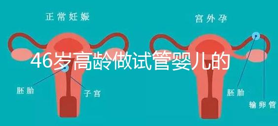 46歲高齡做試管嬰兒的成功幾率有多大？聽聽大家怎么說