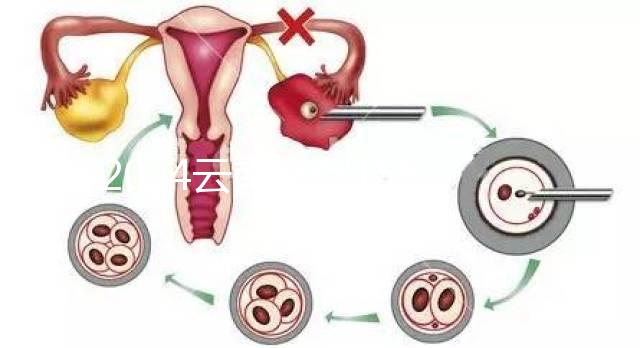 2024云南產假158天怎么算？新政策中，男方培育假貨