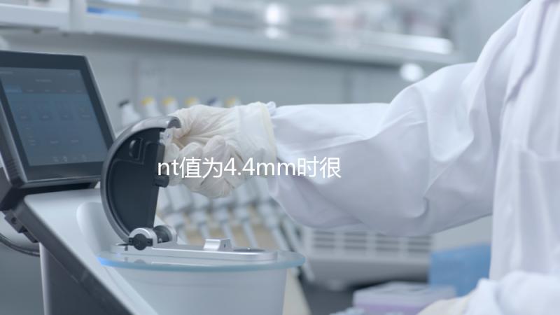 nt值為4.4mm時很危險，及時羊穿確認胎兒畸形很重要