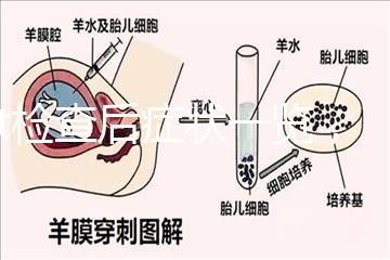tct檢查后癥狀一覽，專家提醒做好處理措施是關鍵